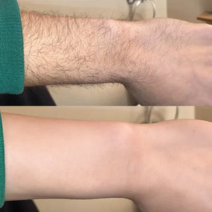 Razorless Body Hair Removal Cream